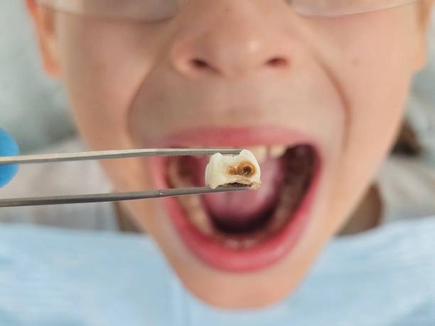 Best Pediatric Emergency Dentist in Port Washington North, NY